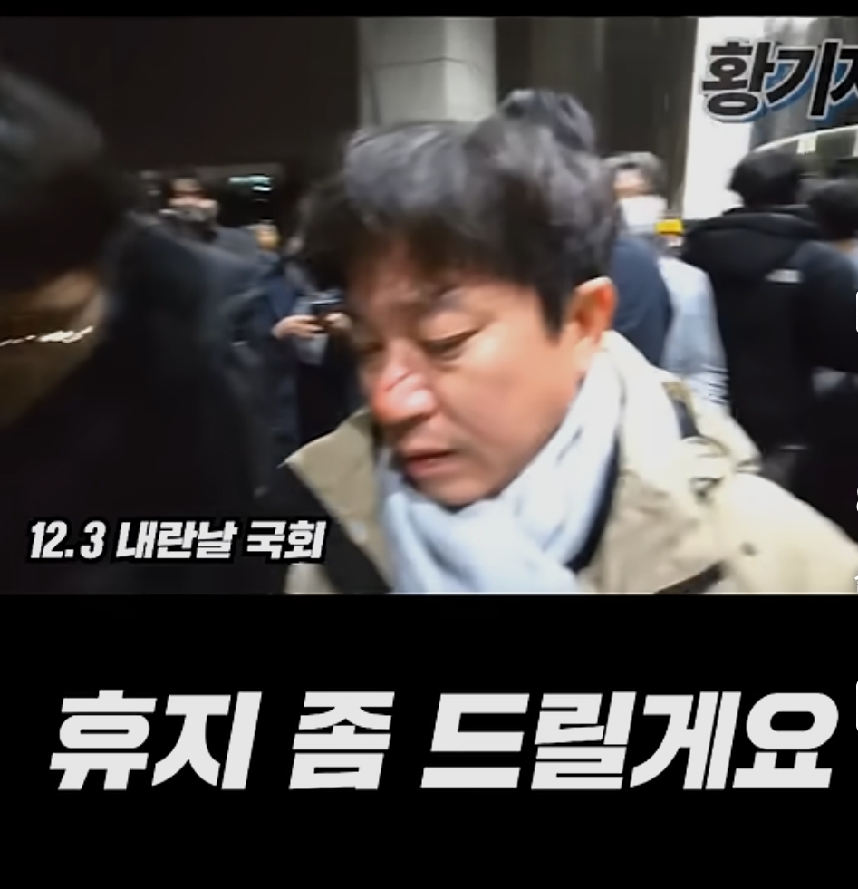 그날 계엄군때문에 안경깨지고 피났던 시민 | 인스티즈