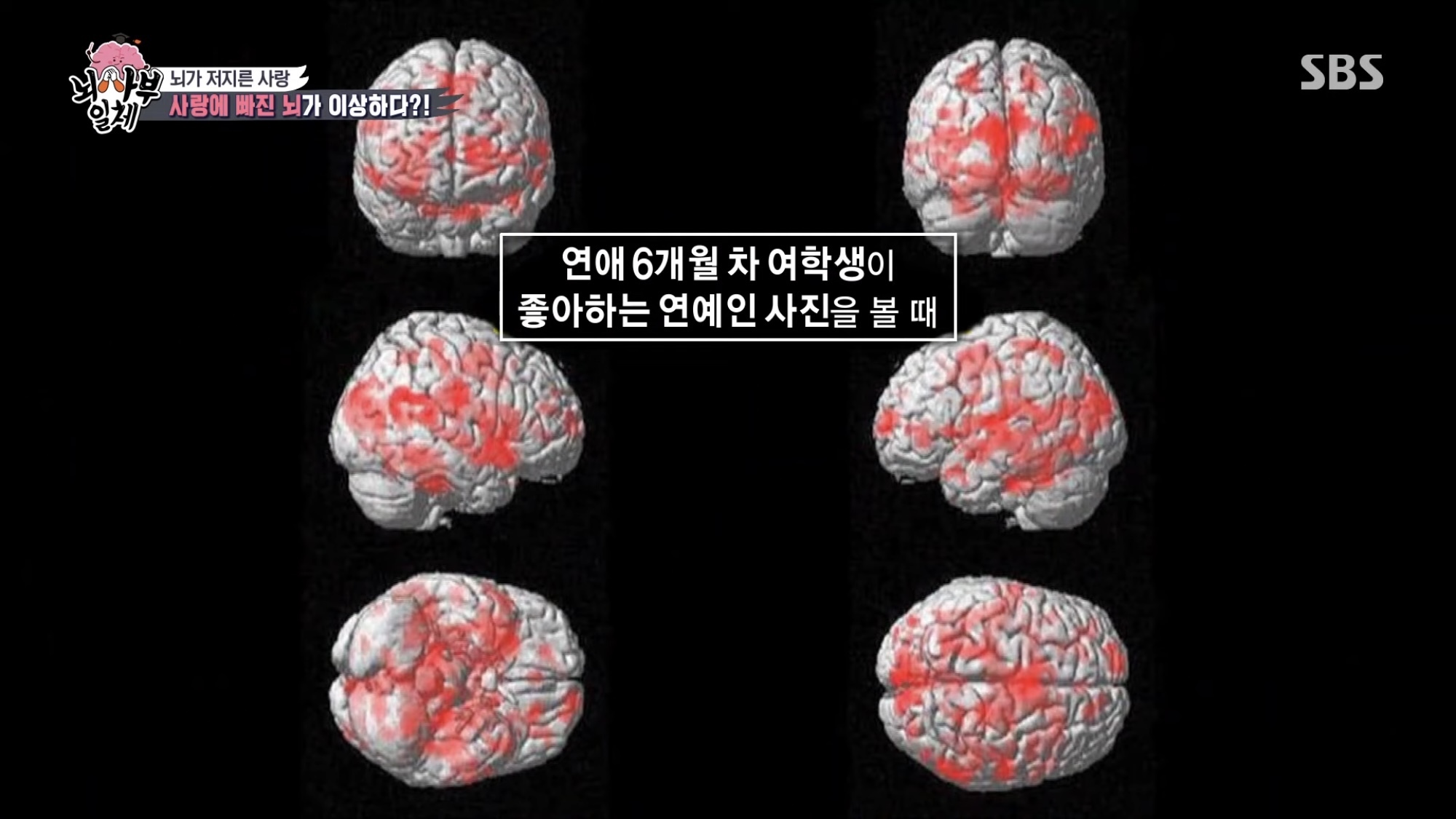 좋아하는 연예인 사진을 보았을 때 우리의 뇌.jpg | 인스티즈