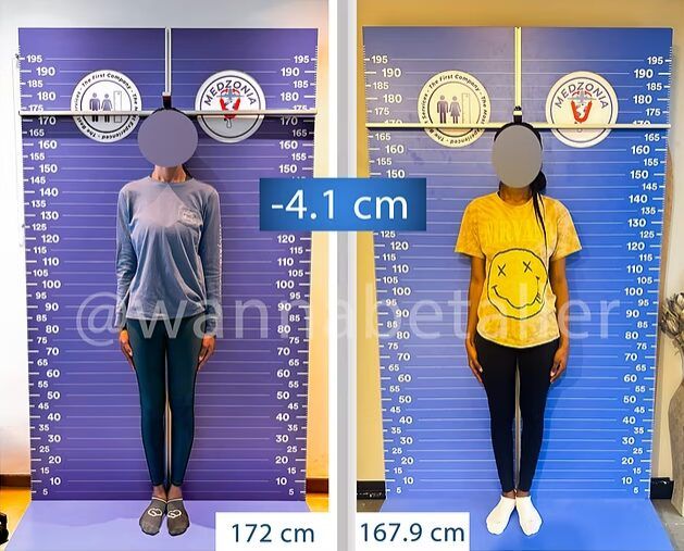 "남친 사귀고 싶어서"..극심한 고통 참고 '이 수술' 받는 여성들 [헬스톡] | 인스티즈