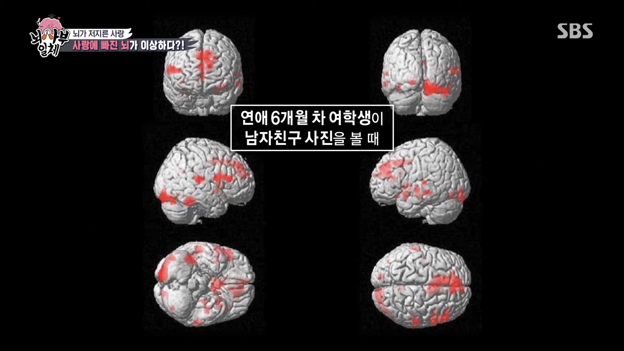 좋아하는 연예인 사진을 보았을 때 우리의 뇌.jpg | 인스티즈