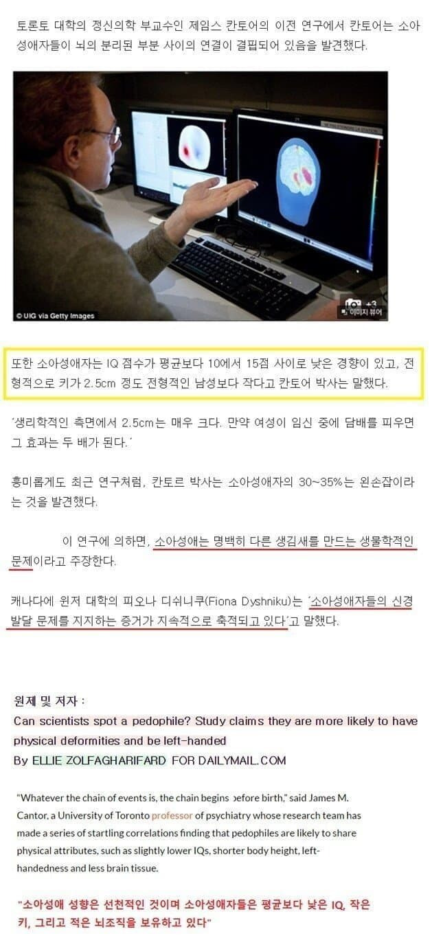 페도필리아 특징.jpg | 인스티즈