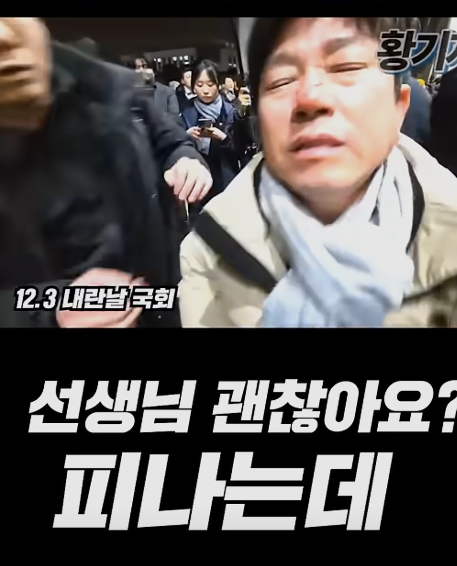 그날 계엄군때문에 안경깨지고 피났던 시민 | 인스티즈