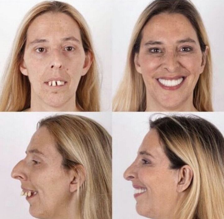 치아교정이 필요한 이유.JPG | 인스티즈