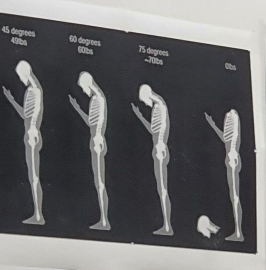거북목 조심해라.jpg | 인스티즈
