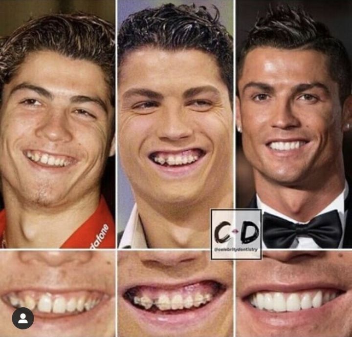 치아교정이 필요한 이유.JPG | 인스티즈