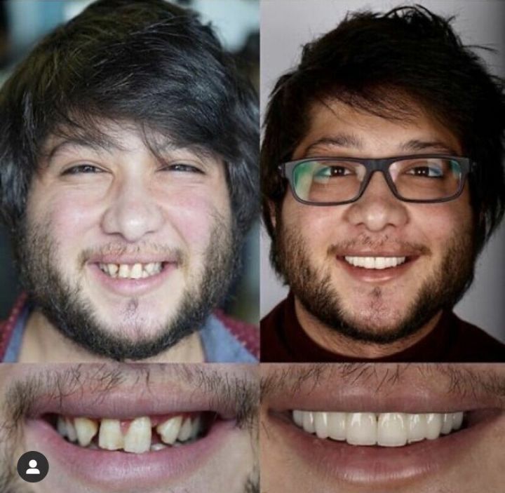 치아교정이 필요한 이유.JPG | 인스티즈