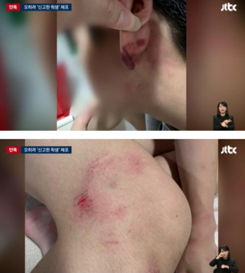 엄한사람 잡은 인천 경찰.jpg/webp | 인스티즈