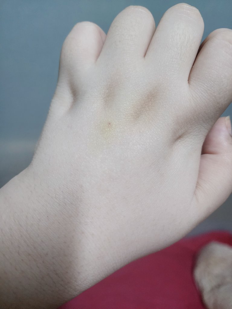 간호사:"왜 혈관을 두고 오셨어요?” | 인스티즈