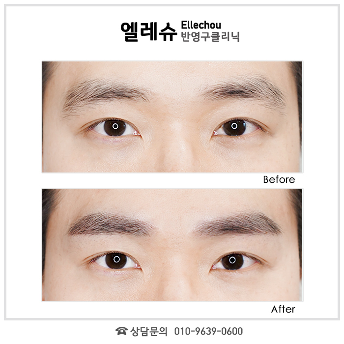 서면엘레슈의원 이미지