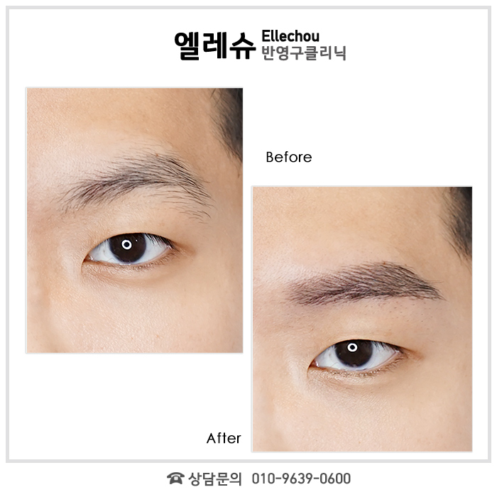 서면엘레슈의원 이미지
