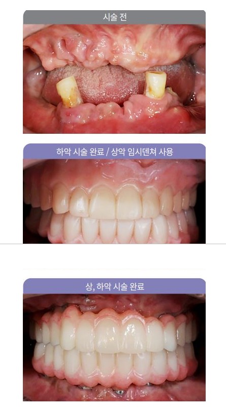 이클린치과의원 이미지