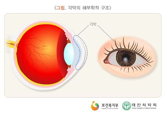Daum 카페