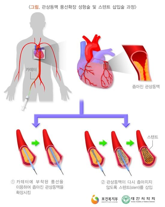 Daum 카페