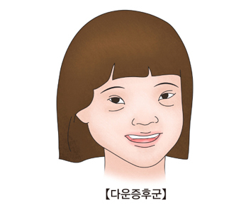다운성 이미지