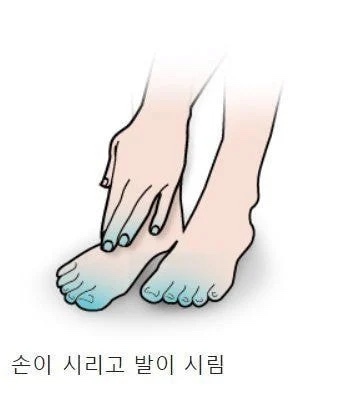 찐 수족냉증 사람들이 수면양말 안 신는 이유 | 인스티즈