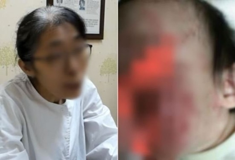 "누가 이기나 보자"…40도 고열인 아기에게 약 안 먹인 엄마 [이슈픽] | 인스티즈