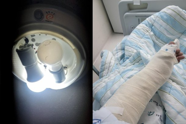 "엘베 전등 깨져 팔 찢겨, 장애인 됐다…관리소장은 보상 거부" | 인스티즈