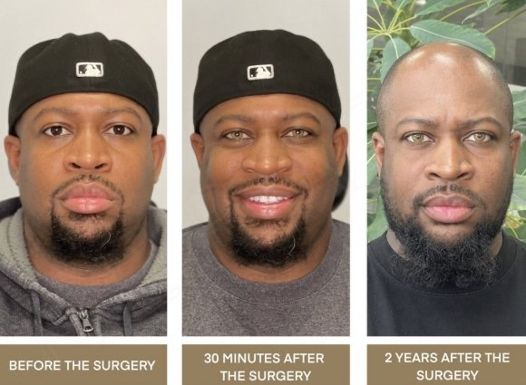 "예쁜가요?"…'눈동자 색깔' 바꾸는 수술 인기몰이 중인 미국 | 인스티즈