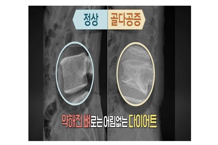 칼슘이 부족하면 살이 안 빠지는 이유 | 인스티즈