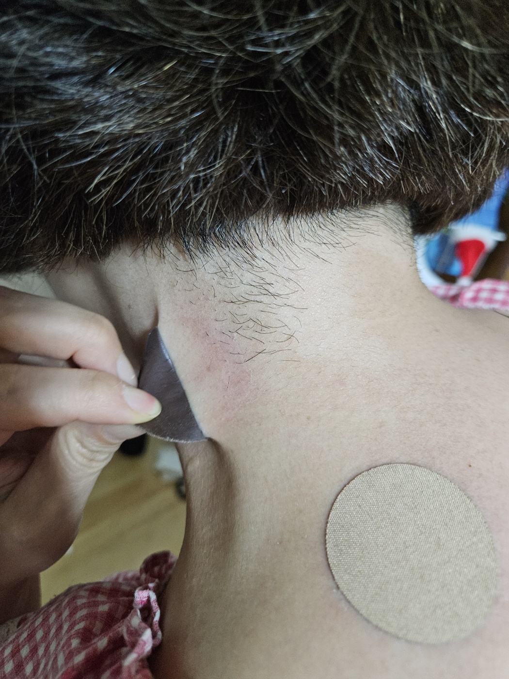 동전파스 부작용 - ◈건강+운동 - 달콤 씁쓸