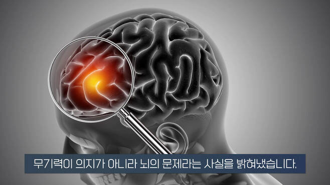 무기력한 사람들의 뇌 MRI 찍어보니.. 소름돋는 결과 | 인스티즈