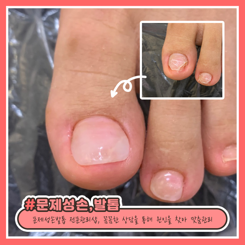 베티네일 이미지