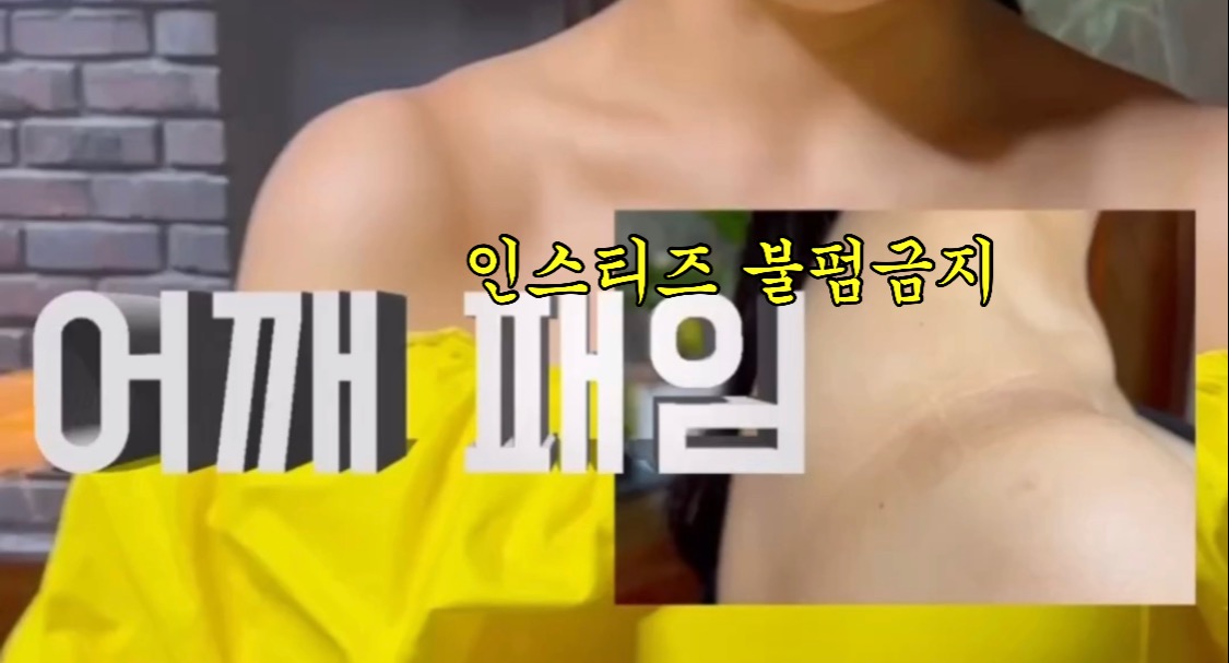 가슴 무게가 너무 크면 생기는 어깨 패임 | 인스티즈