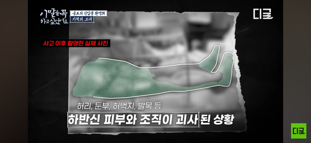 10년째 병원에 계신다는 경주 마우나리조트 사고 생존자… | 인스티즈