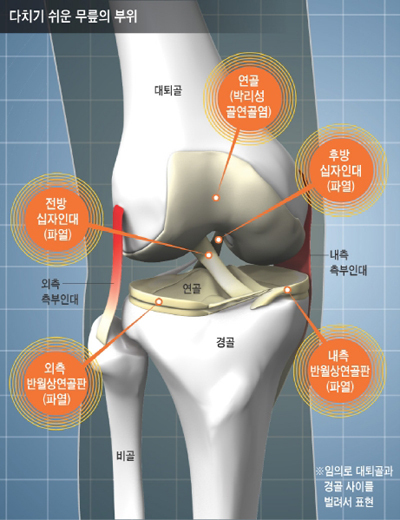 뼈 인대등 다쳐본 사람은 공감하는것 | 인스티즈