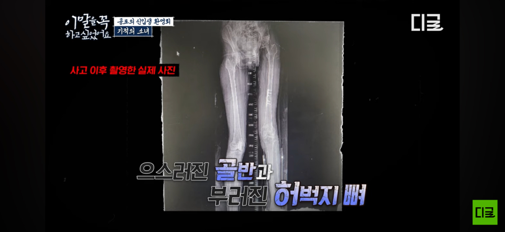 10년째 병원에 계신다는 경주 마우나리조트 사고 생존자… | 인스티즈