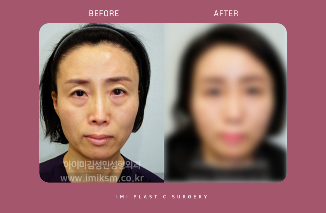 디자인여백 이미지
