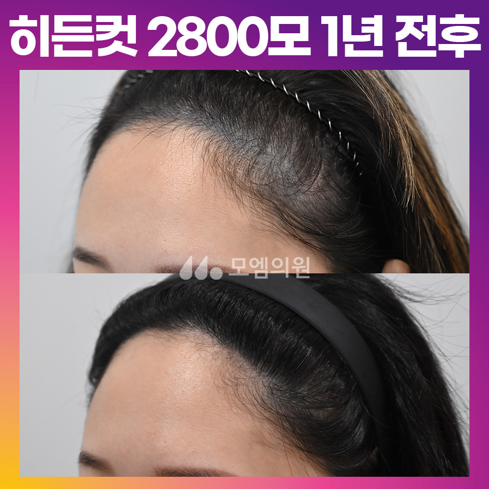 후헤어 이미지
