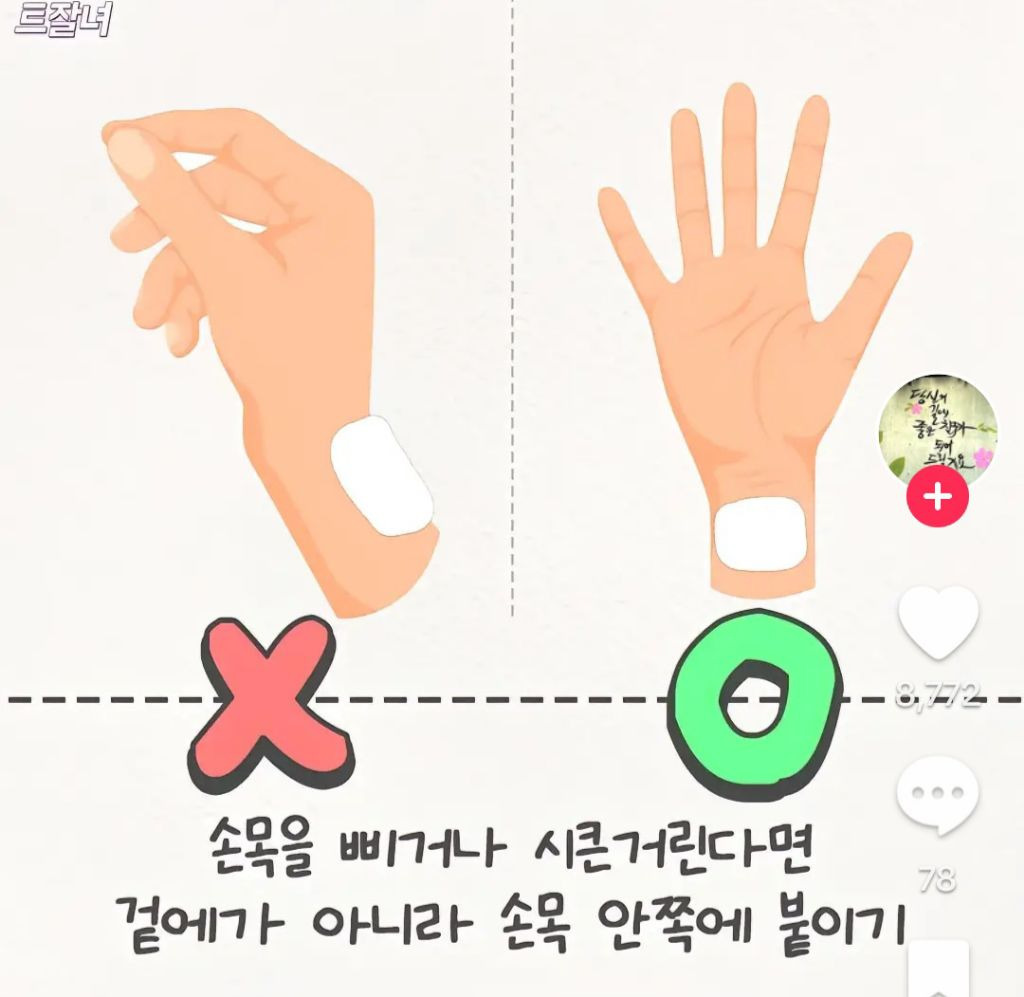 파스 이미지