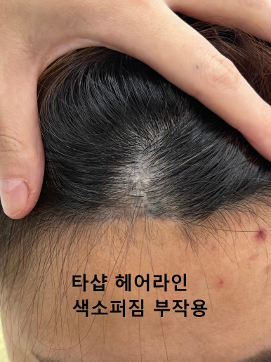 현헤어라인 이미지