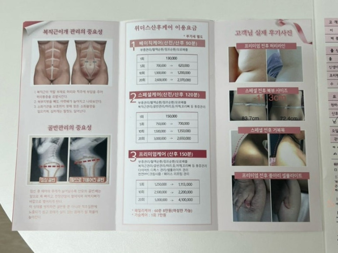 비포에프터 이미지