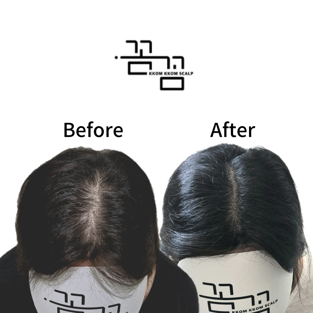 가르마 이미지