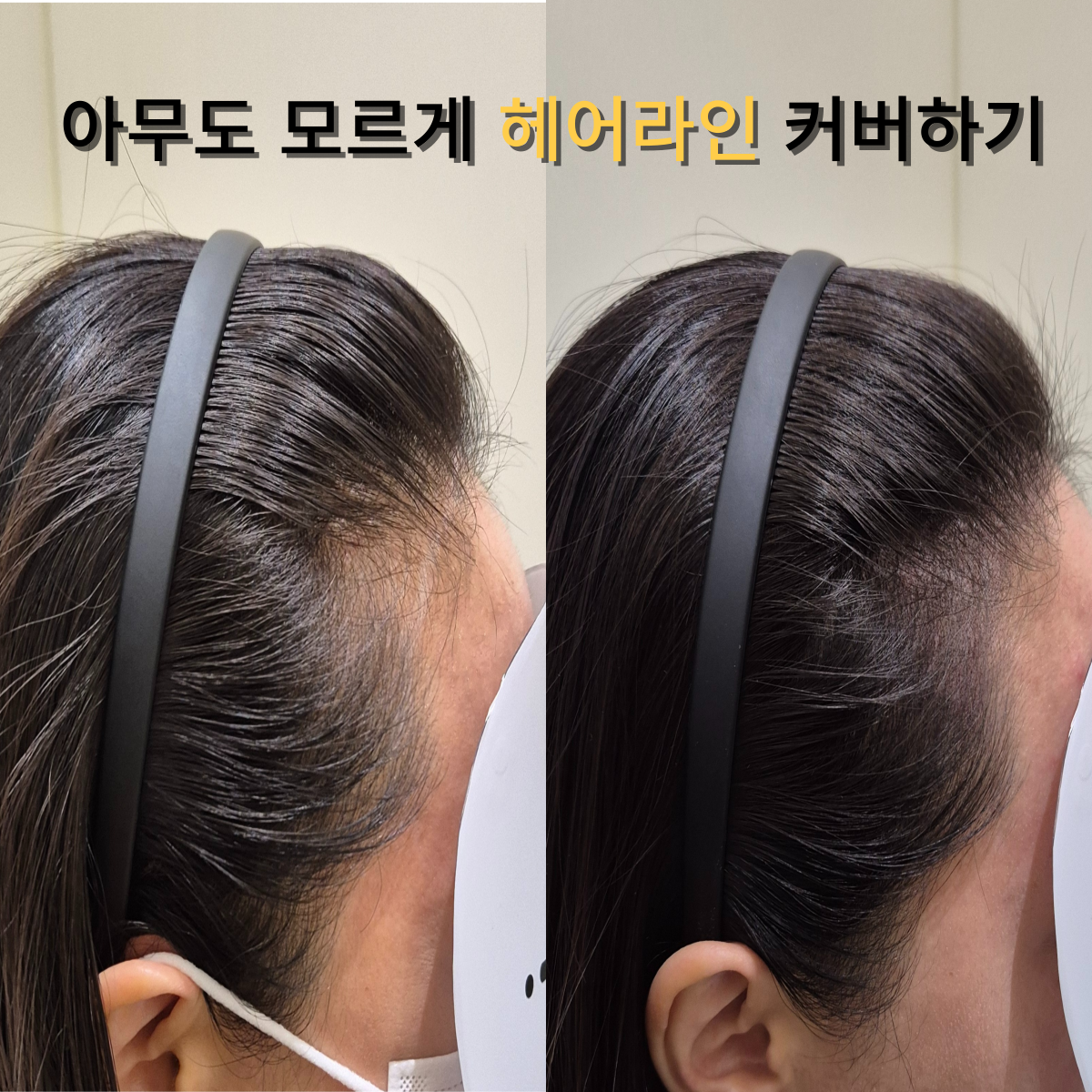 헤어라인 이미지