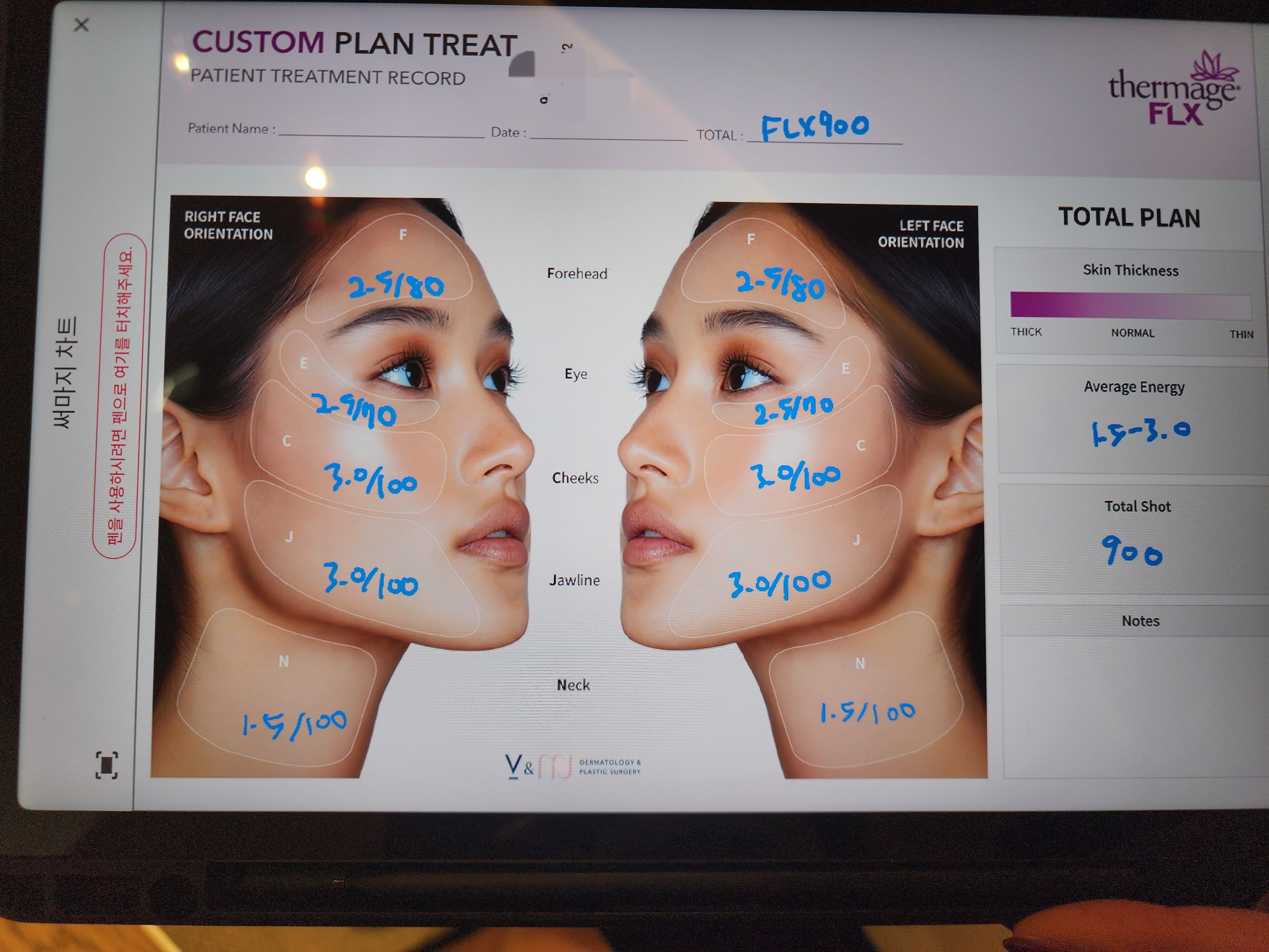 게시글 대표 이미지