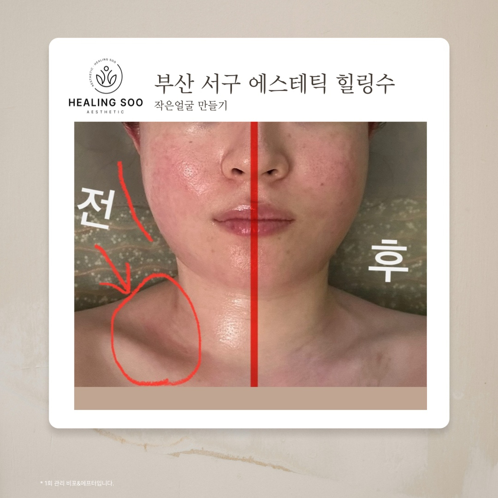 에스테틱 힐링수 이미지