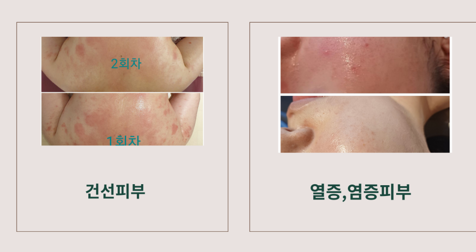 황금마사지 피부관리 이미지