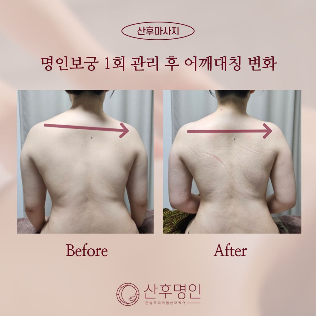 산후명인수원 이미지