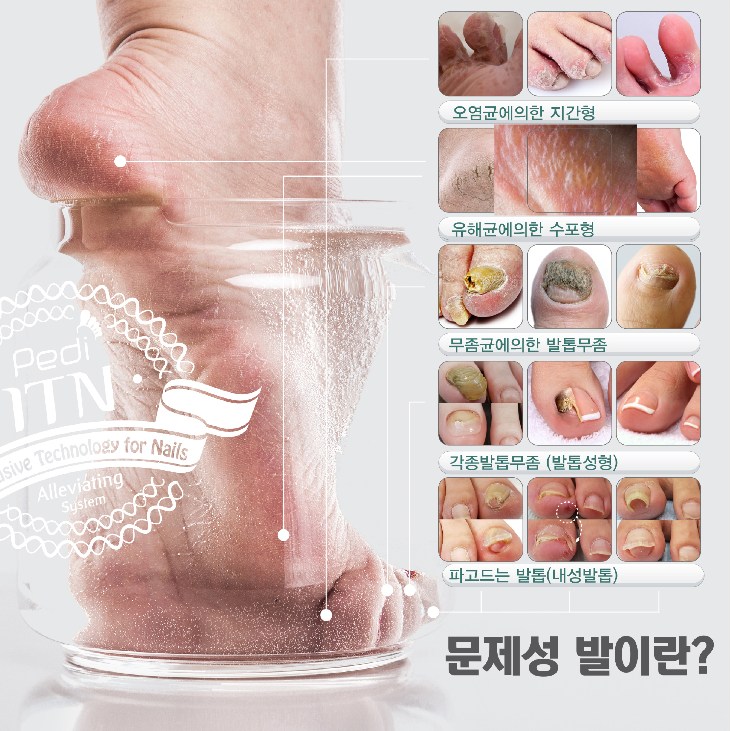 페디Bio 이미지