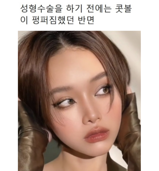 외국인들이 한국와서 성형하는 이유 | 인스티즈