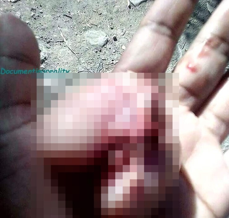 (사진주의) 남편이 바람피는 거 보고 ㅂㅇ을 잘라버린 아내 | 인스티즈