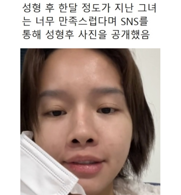 외국인들이 한국와서 성형하는 이유 | 인스티즈