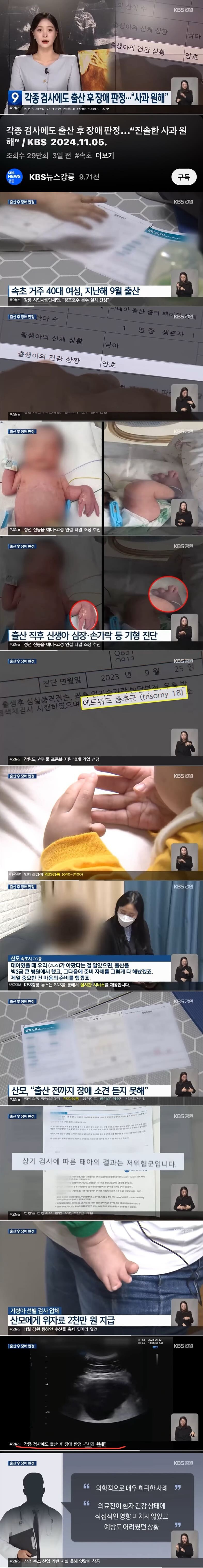 출산때까지 장애 진단 놓친 의사 | 인스티즈