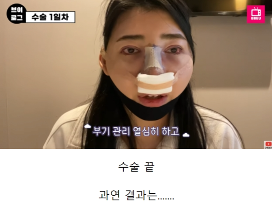 외국인들이 한국와서 성형하는 이유 | 인스티즈