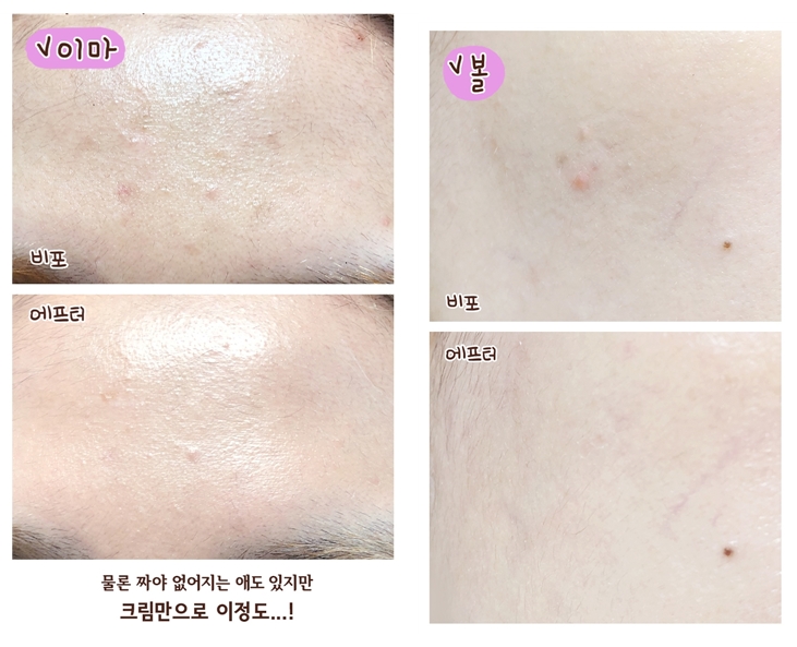 Daum 카페