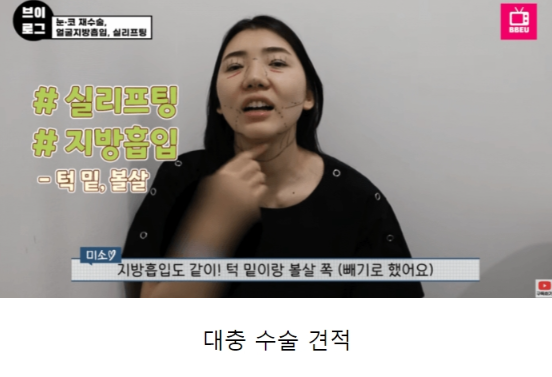 외국인들이 한국와서 성형하는 이유 | 인스티즈