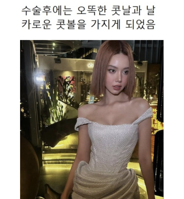 외국인들이 한국와서 성형하는 이유 | 인스티즈